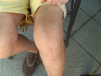 Mittwoch, 29.07.09. Treffen im Hffer Hof im Biergarten